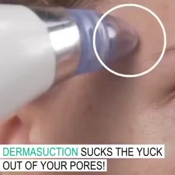 Derma Suction Vacuum – Deep Pore Blackhead Remover & Facial Cleansing Device